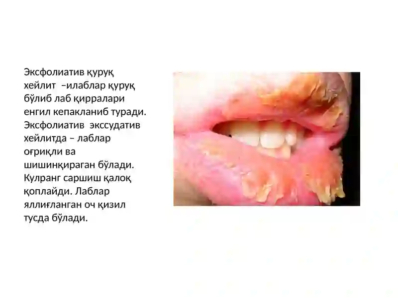 Preview 4