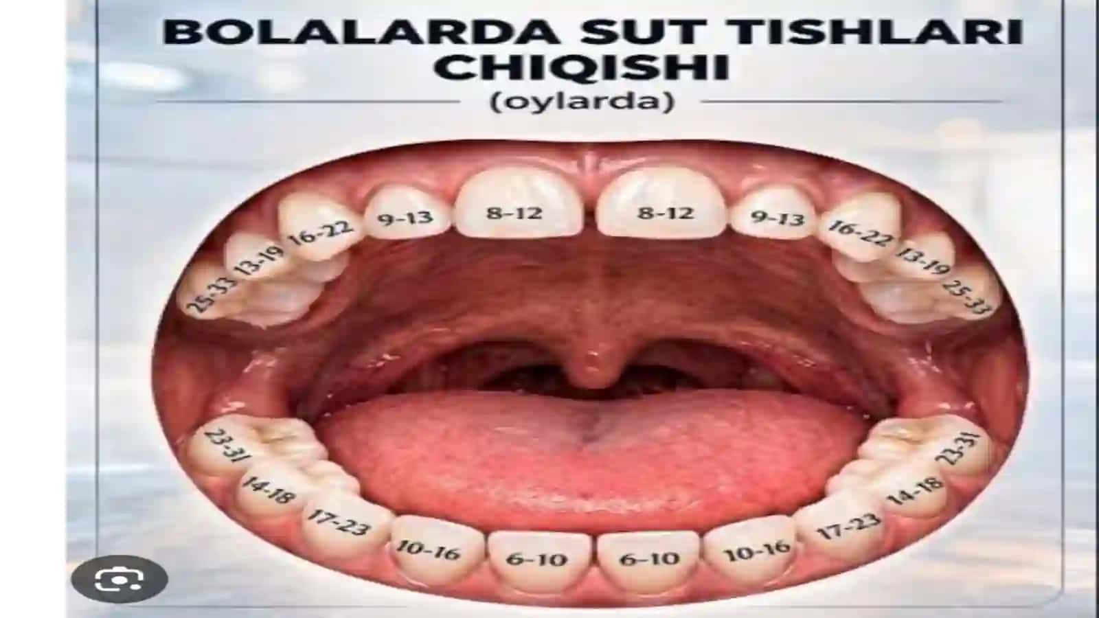 Sut tishlari kariesi 4