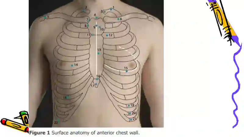 THE chest 4