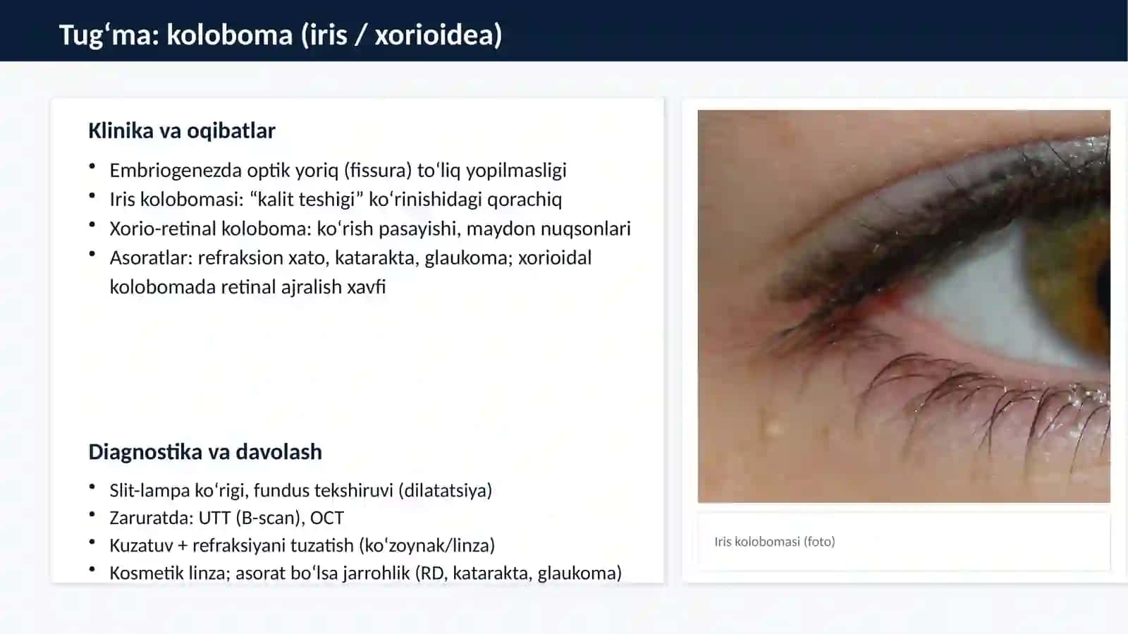 Tomirli qavat (uvea) 4