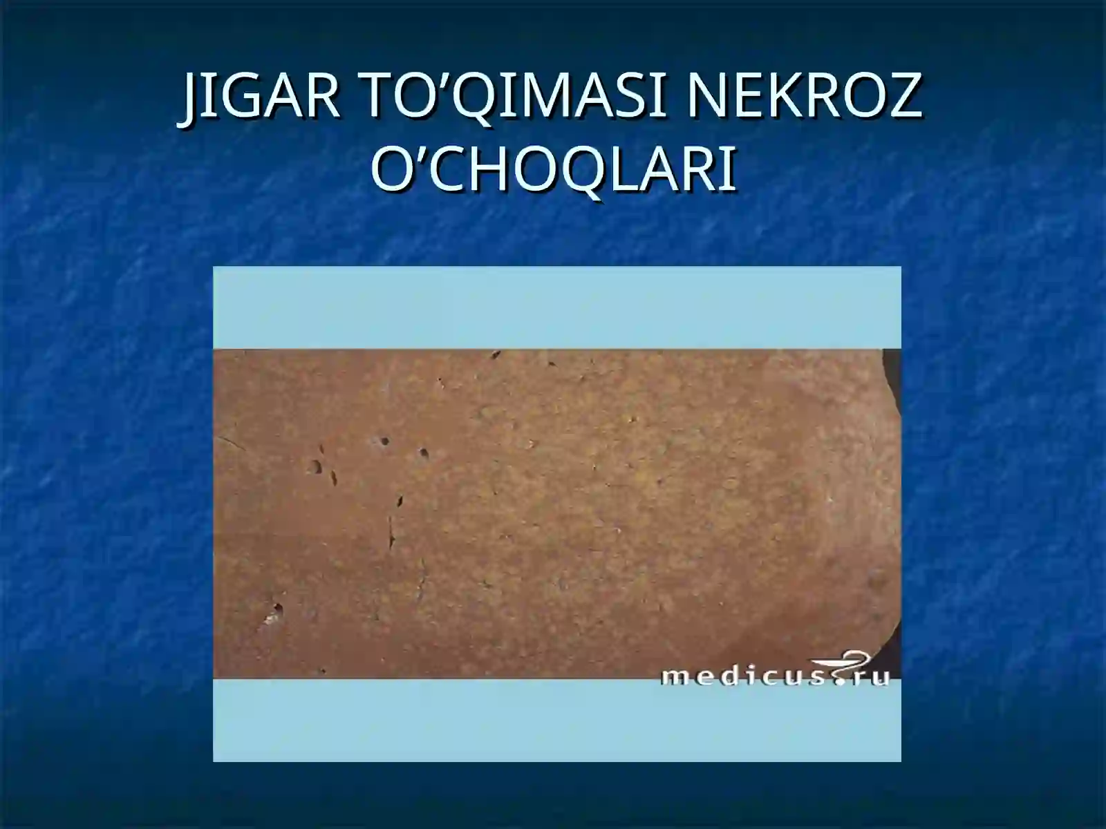 JIGARSIRROZI 4
