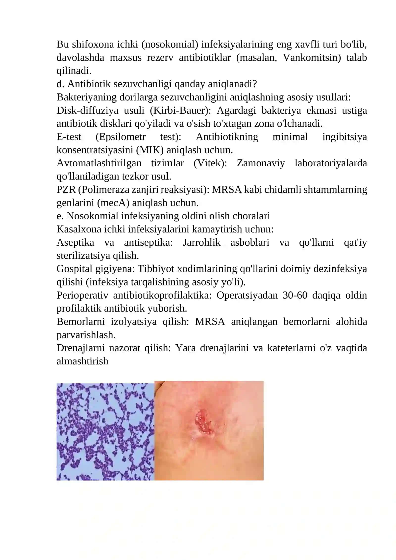 MIKROBIOLOGIYA FANIDAN VAZIYATLI MASALALARIGA VA LABARATORIYA SAVOLLARIGA JAVOBLAR MALUMOTLAR GOOGLE ASOSIDA QISQACHA 4