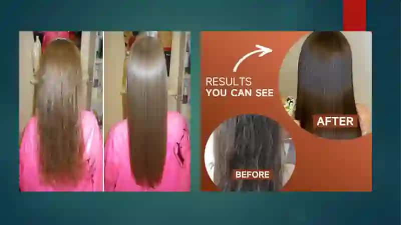 Keratinizatsiya jarayonlari haqida zamonaviy tasavvurlar. Soch follikulasining sikli (soch o'sishi sikli) va uning klinik ahamiyati 4