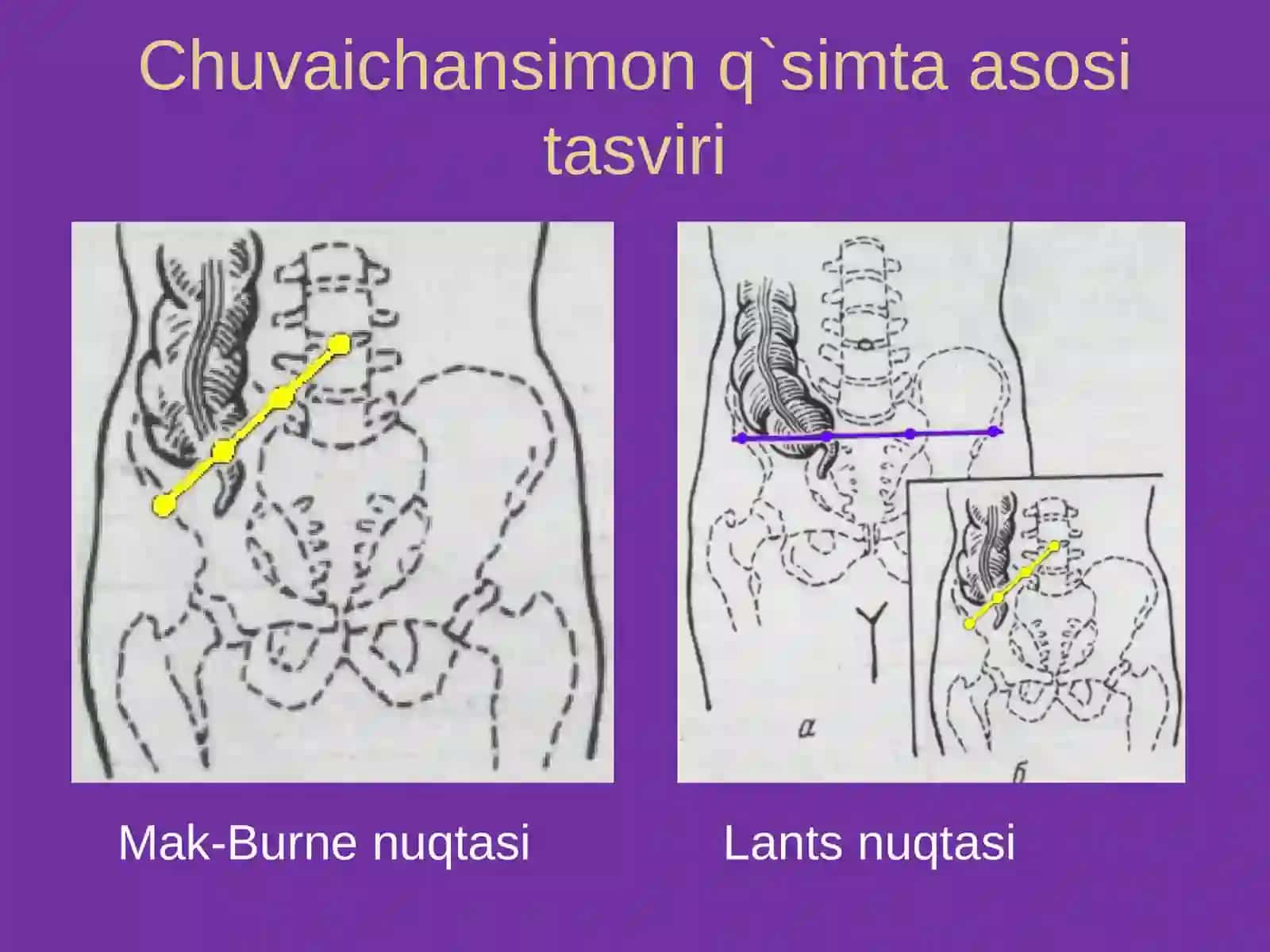 Qorin old-yon devorining klinik anatomiyasi 4