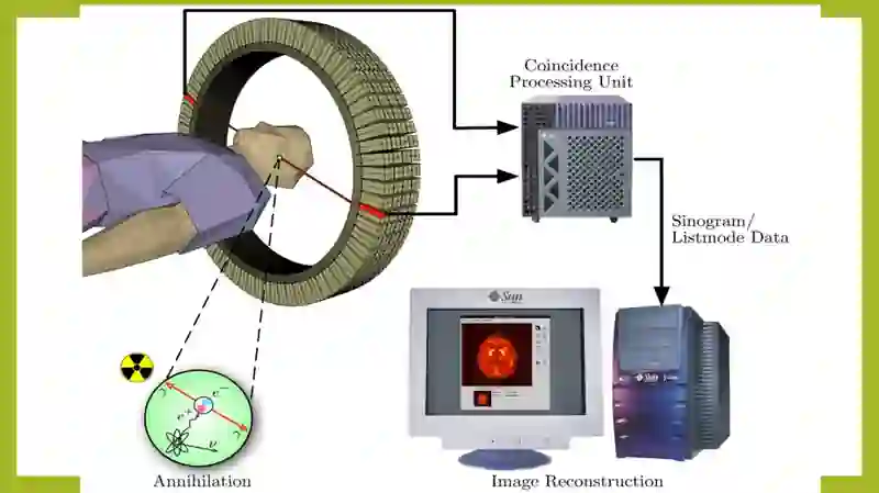 Pozitron-emission tomografiya 4