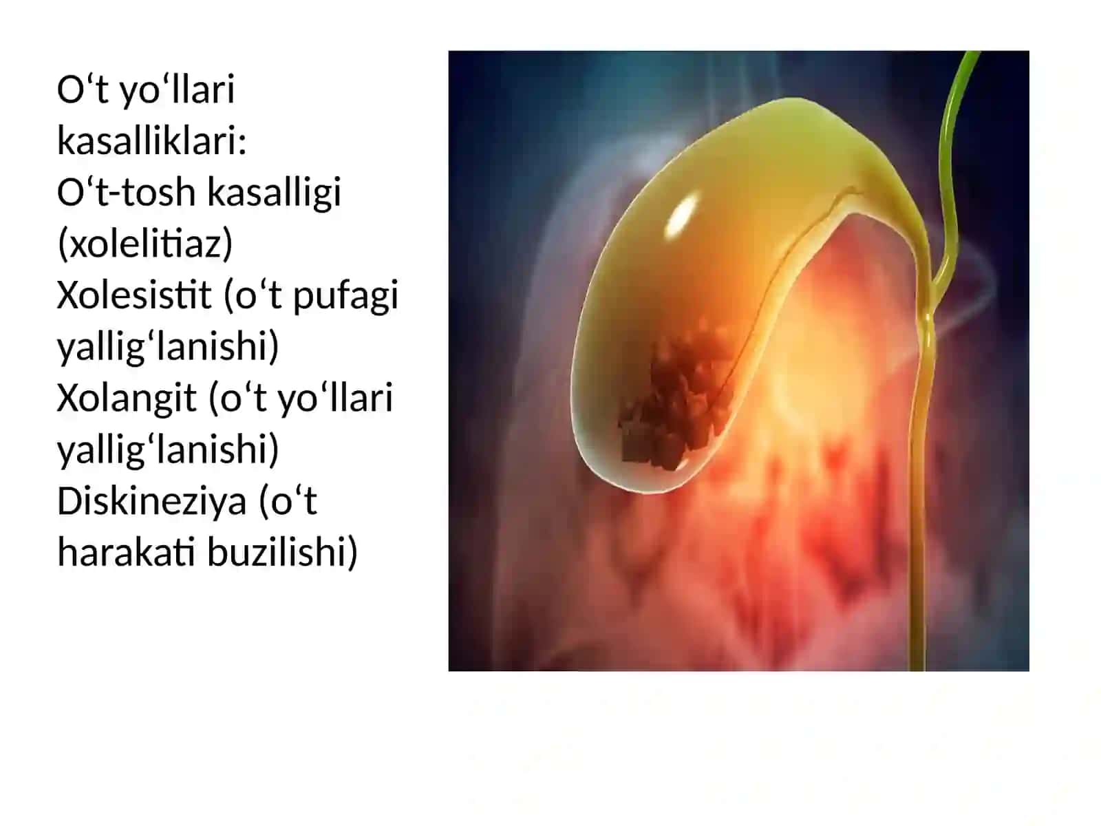 Jigar kasalliklari. O‘t-tosh kasalligi 4