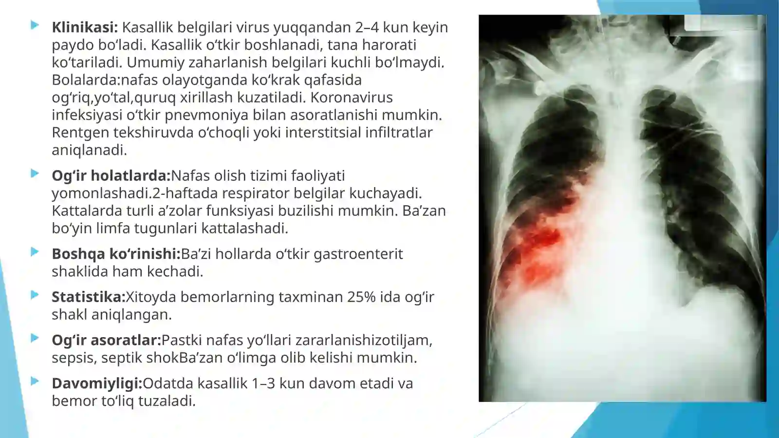 Virusli infeksiyalar 4