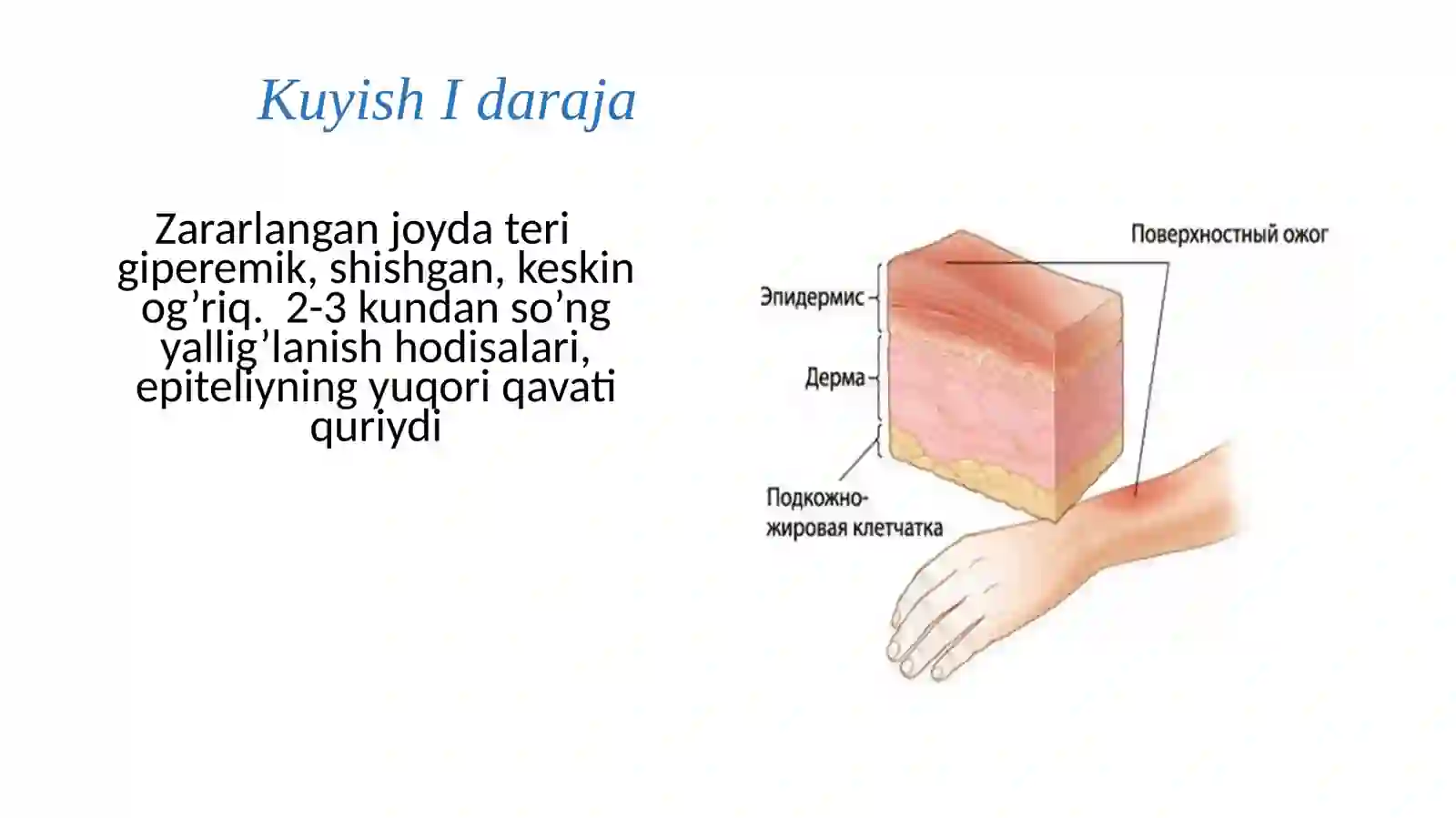Kuyish kasalli 4