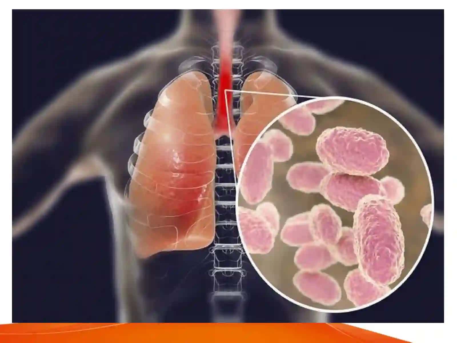 slaytBakteriyalarning antibiotiklarga chidamli shakllarini paydo bo`lish mexanizmlari. haqidada to'liq ma'lumot 4