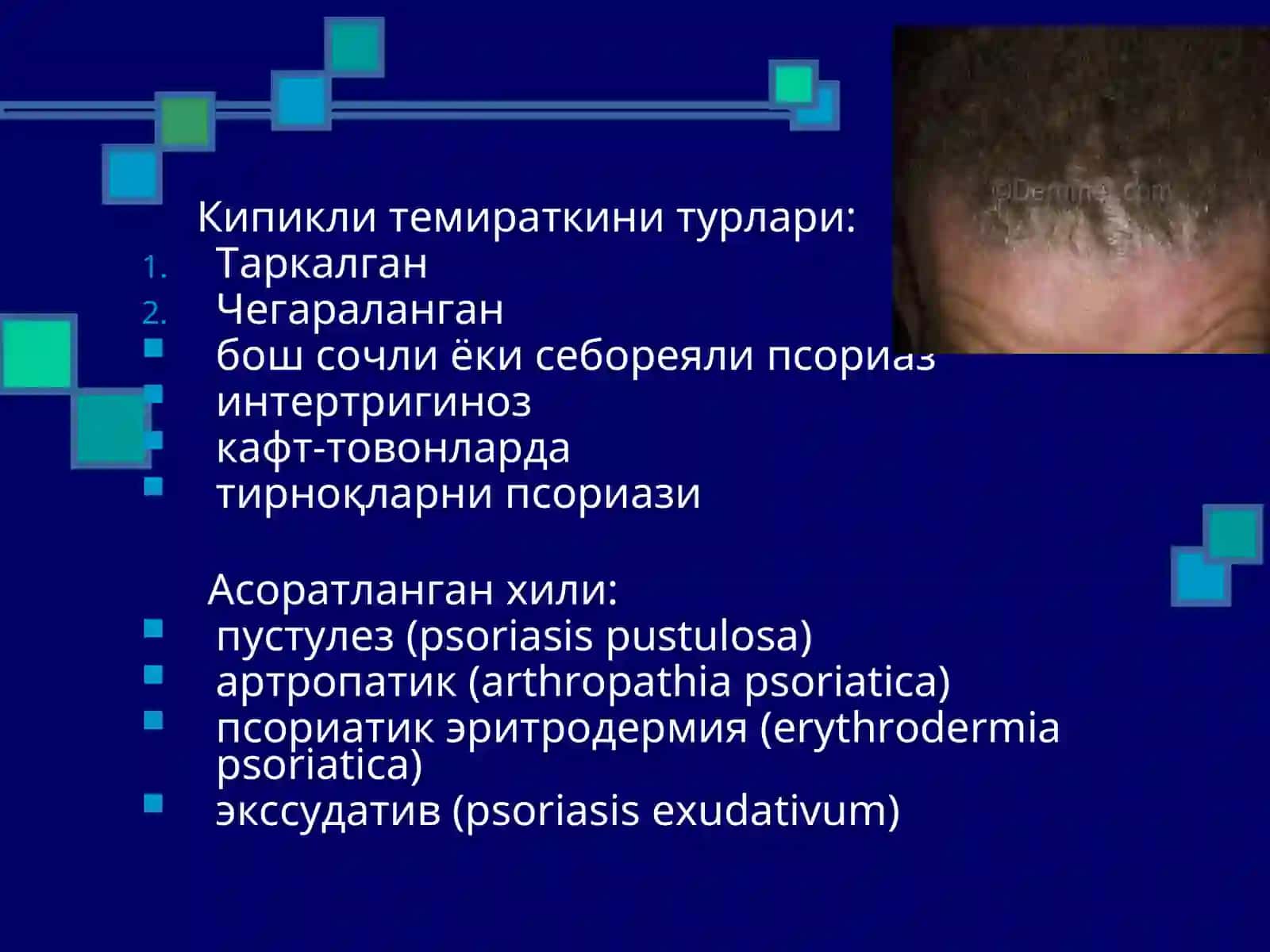 Псориаз 4