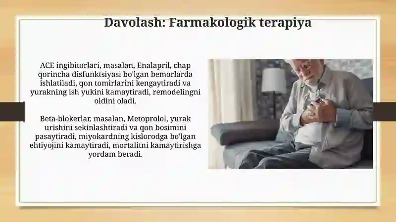 Miokard infarkti 4