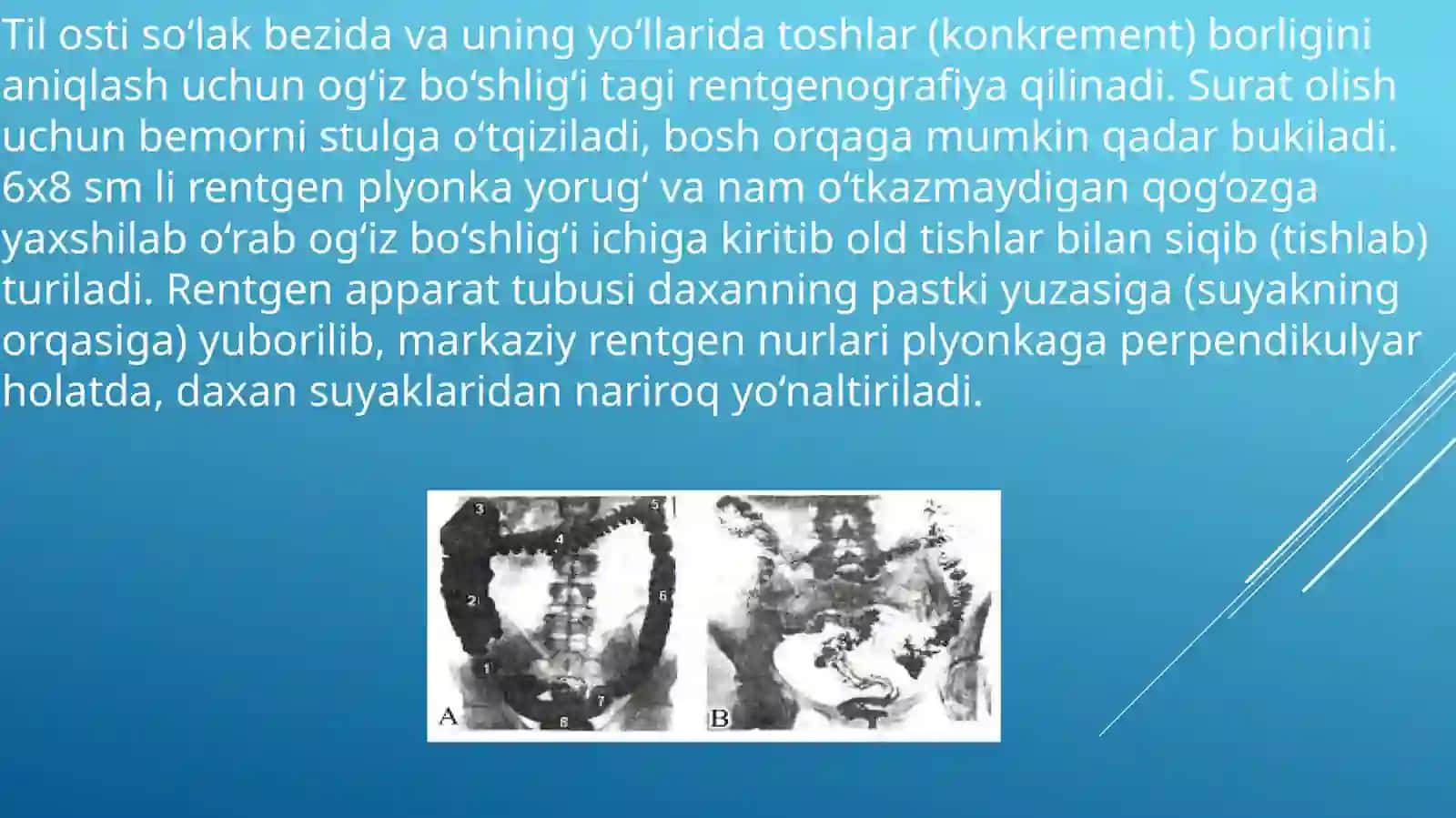Rentgenanatomiya va rivojlanishidagi nuqsonlar 4