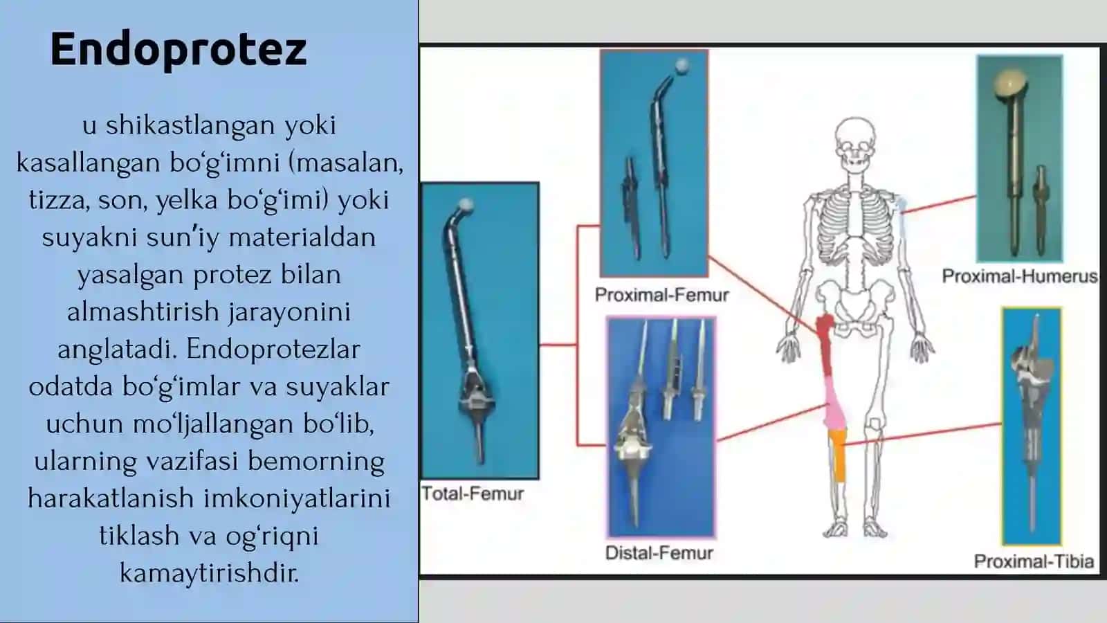 Suyaklar patologiyalari. Endoprotezlash. Osteoparoz. Osteoartrit 4