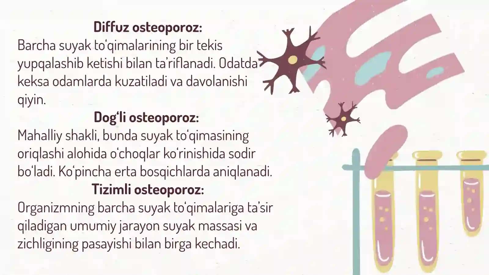 Osteoporoz 4