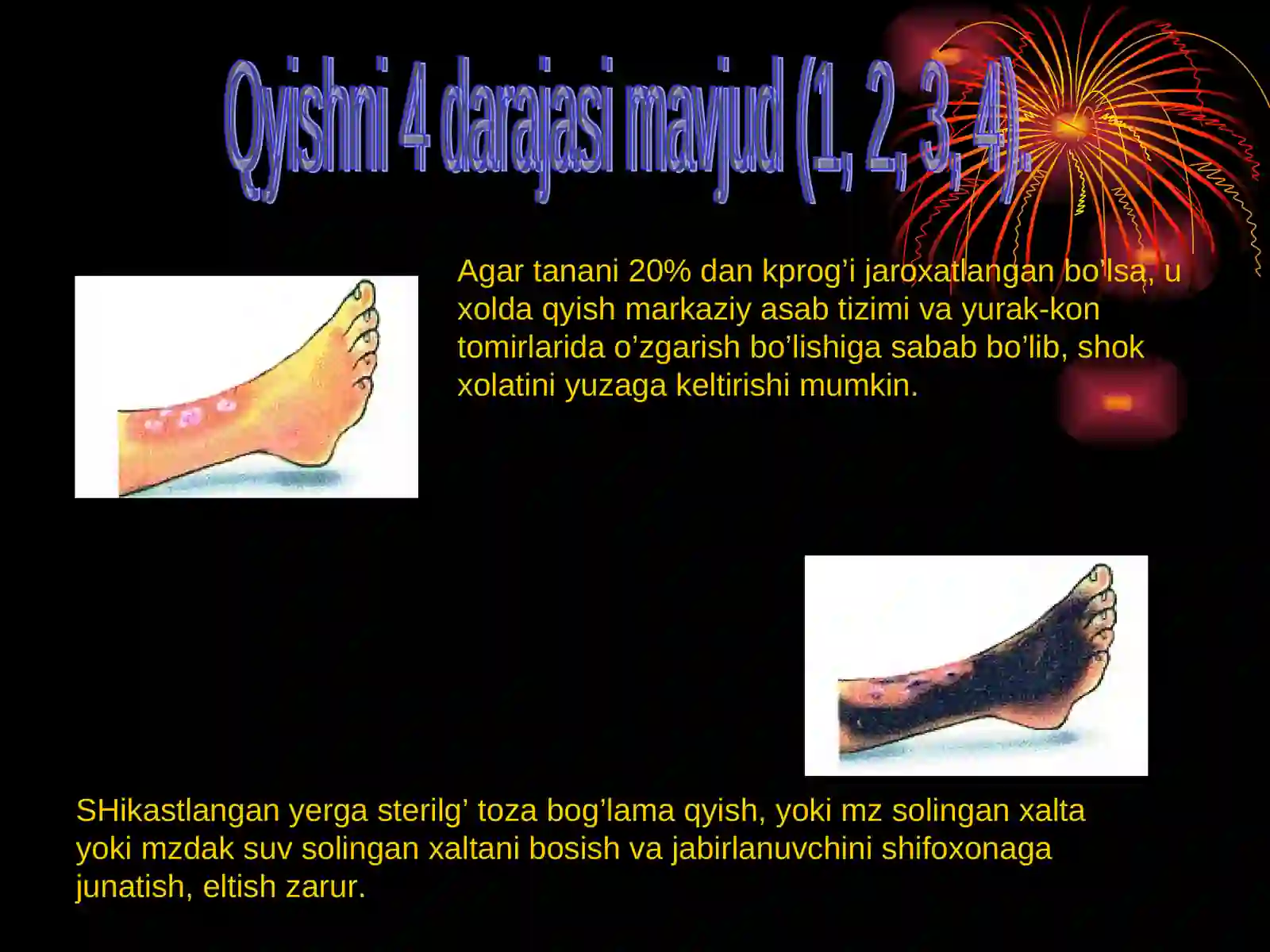 KUYISH DARAJALARI 4