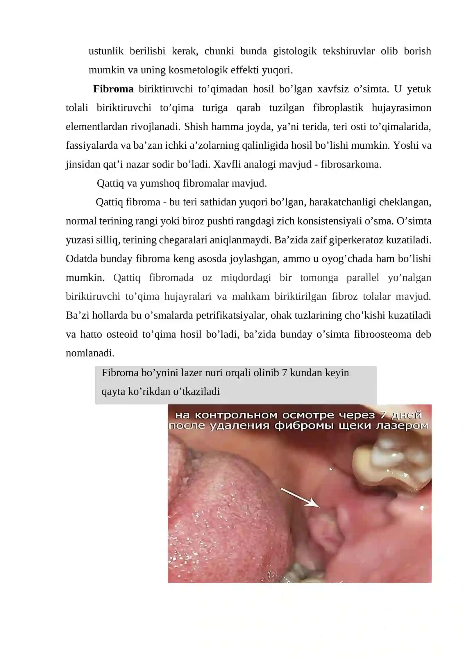 Yassi hujayrali papilloma 4