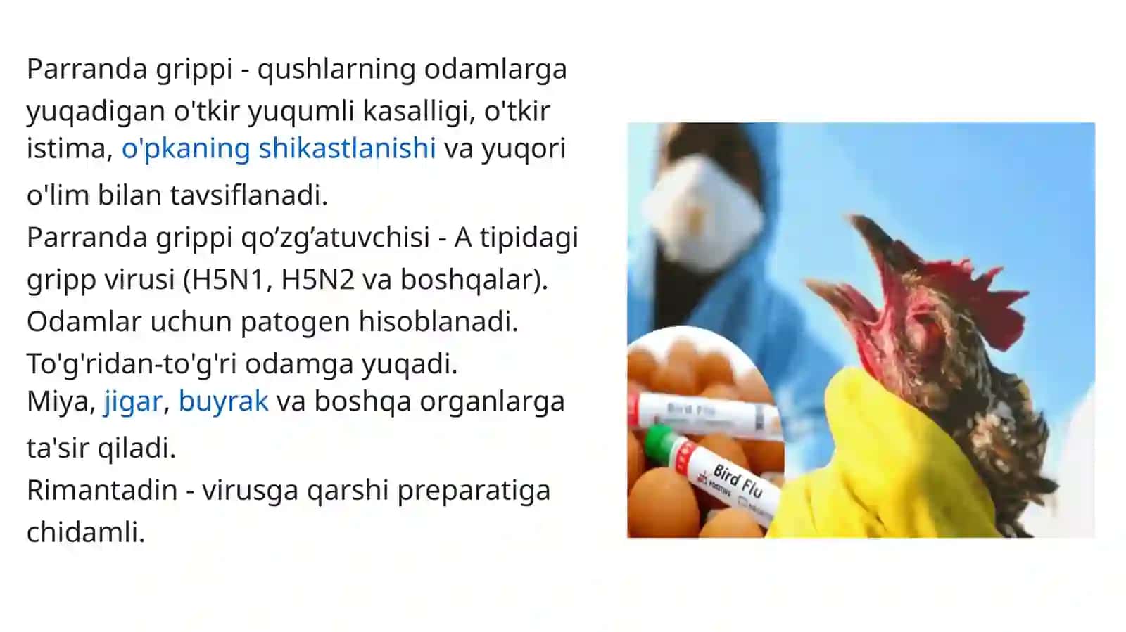Parrandagrippi va uning xozirgi kundagi muammolari 4