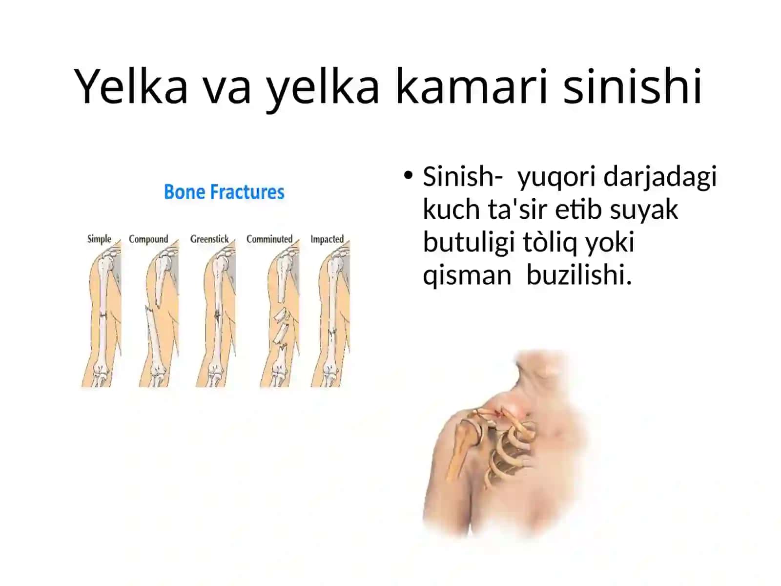 Yelkavayelkakamari 4