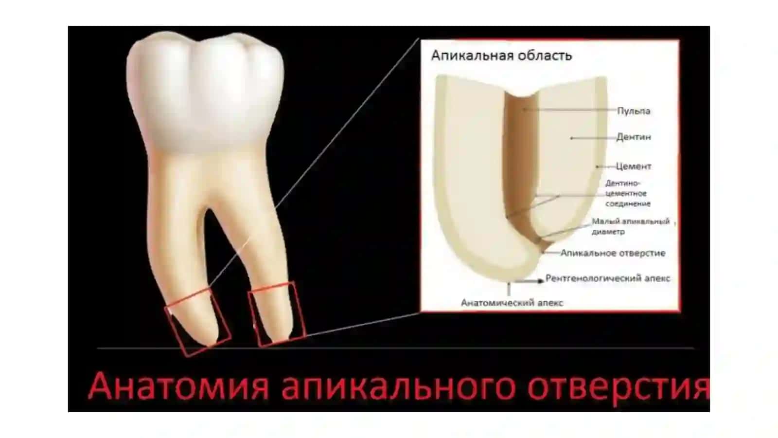 Мягкая ткань зуба 4