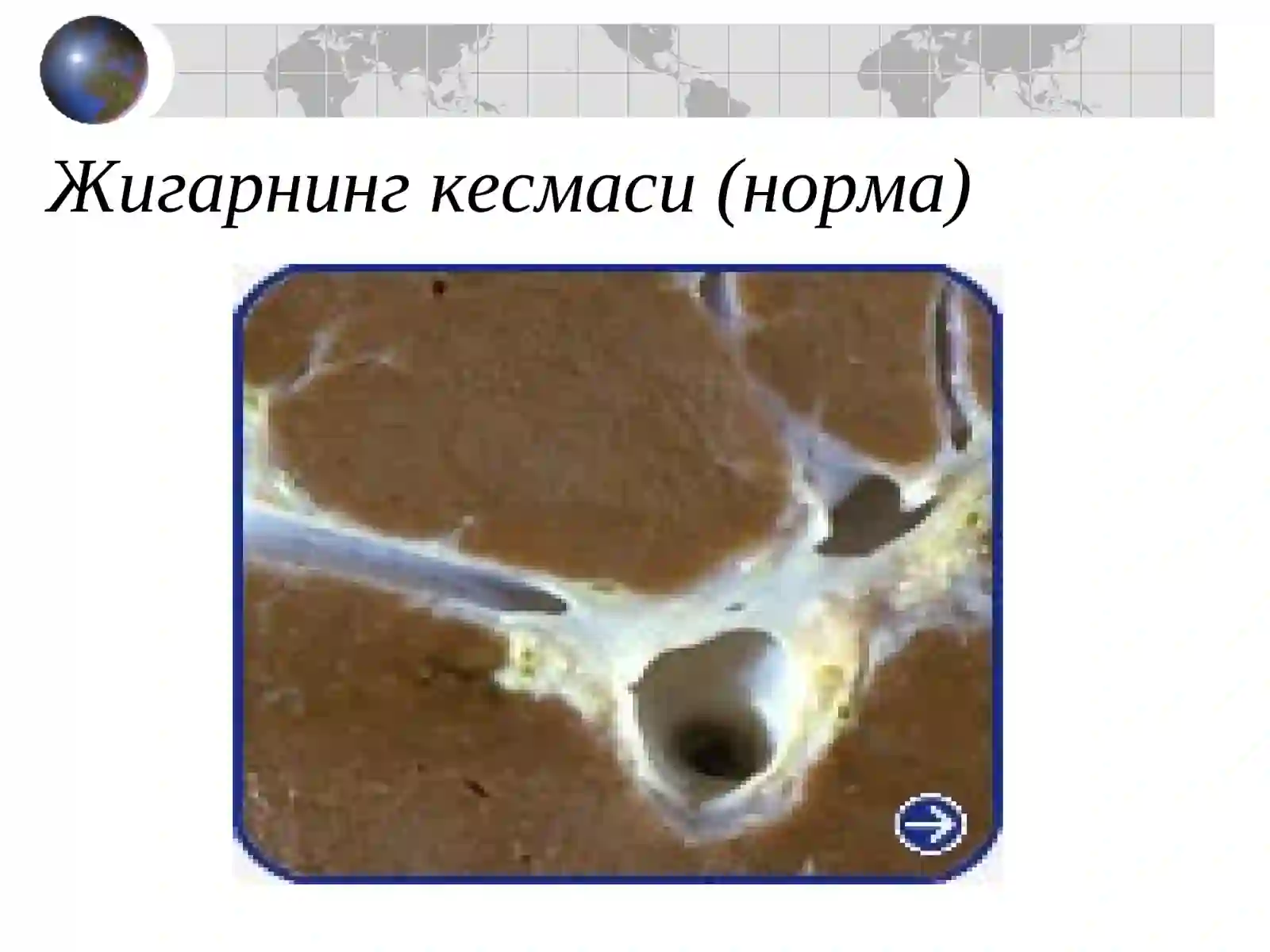 СУРУНКАЛИ ГЕПАТИТ 4