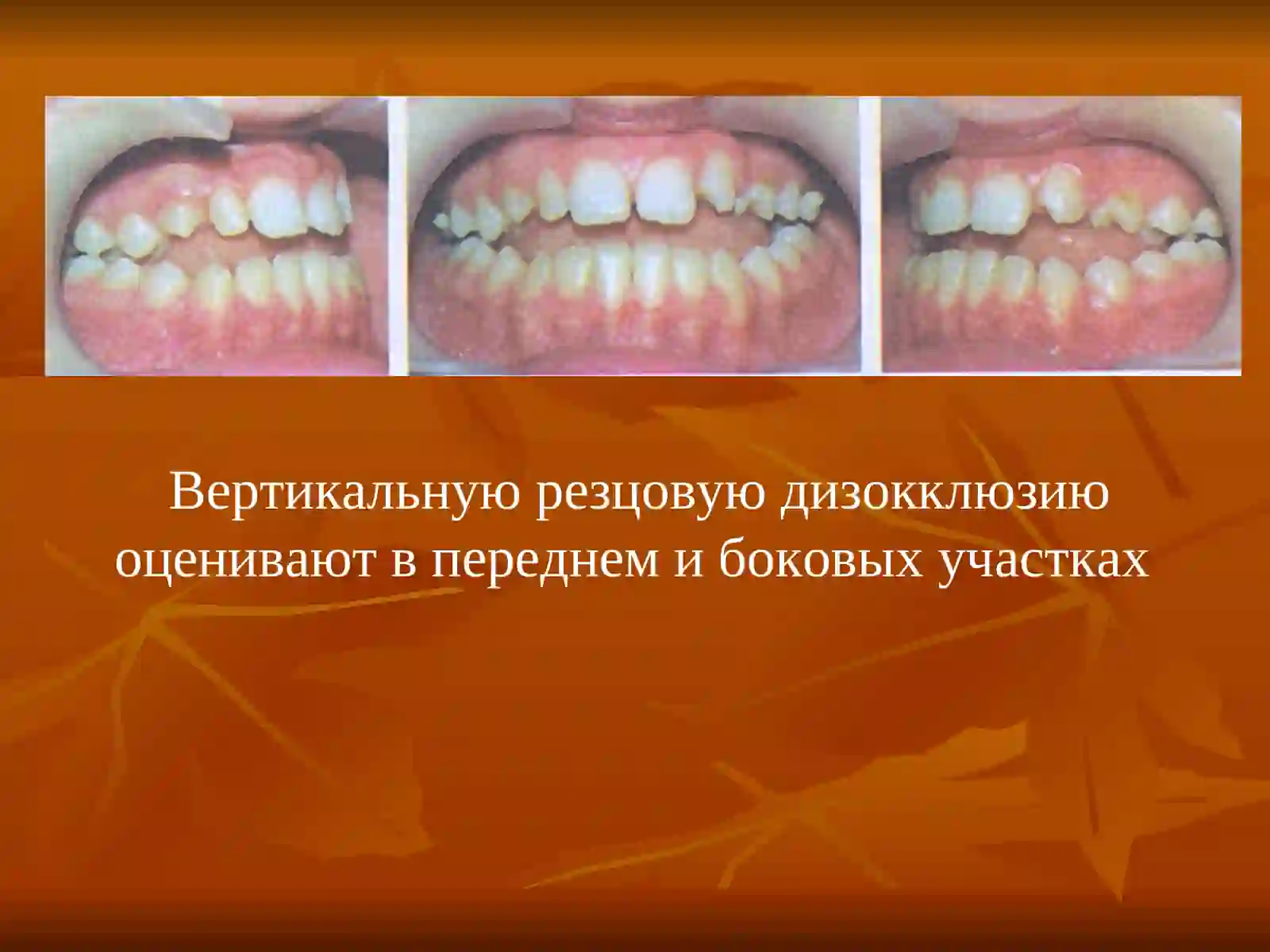 ОТКРЫТЫЙ ПРИКУС 4