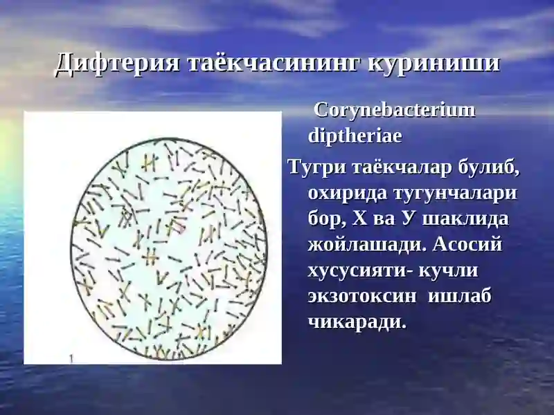 Дифтерия 4