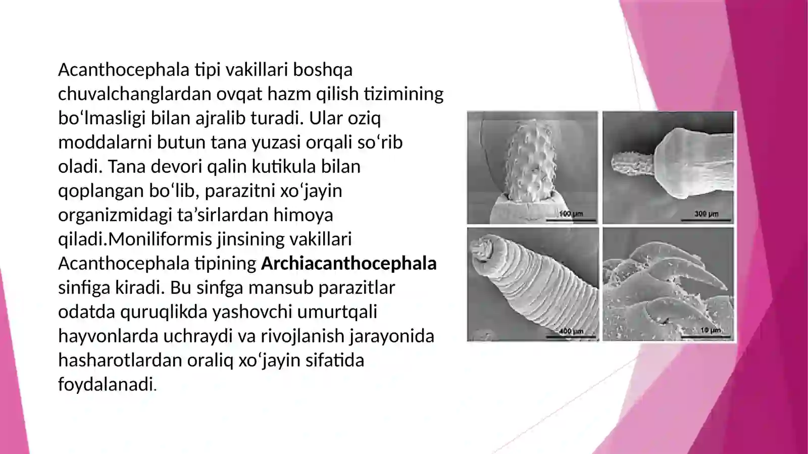 Moniliformis parazit chuvalchanglar 4