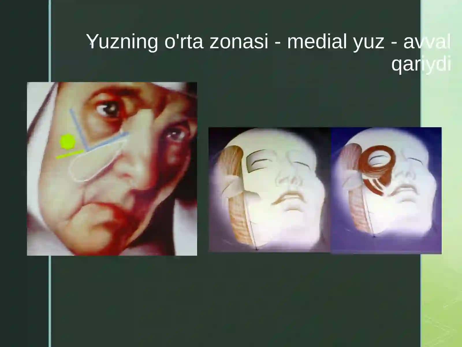 Yuz va buyin sohalarida estetik operativ xarakatlar. Operativ davolash usullari (quloq suprasi korreksiyasi, blefaroplastika, Yuz ajinlarini bartaraf etish va boshqalar) 4