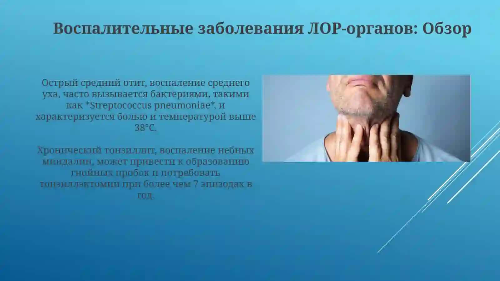 Воспалительные и опухолевые заболевания ЛОР-органов и слюнных желез 4