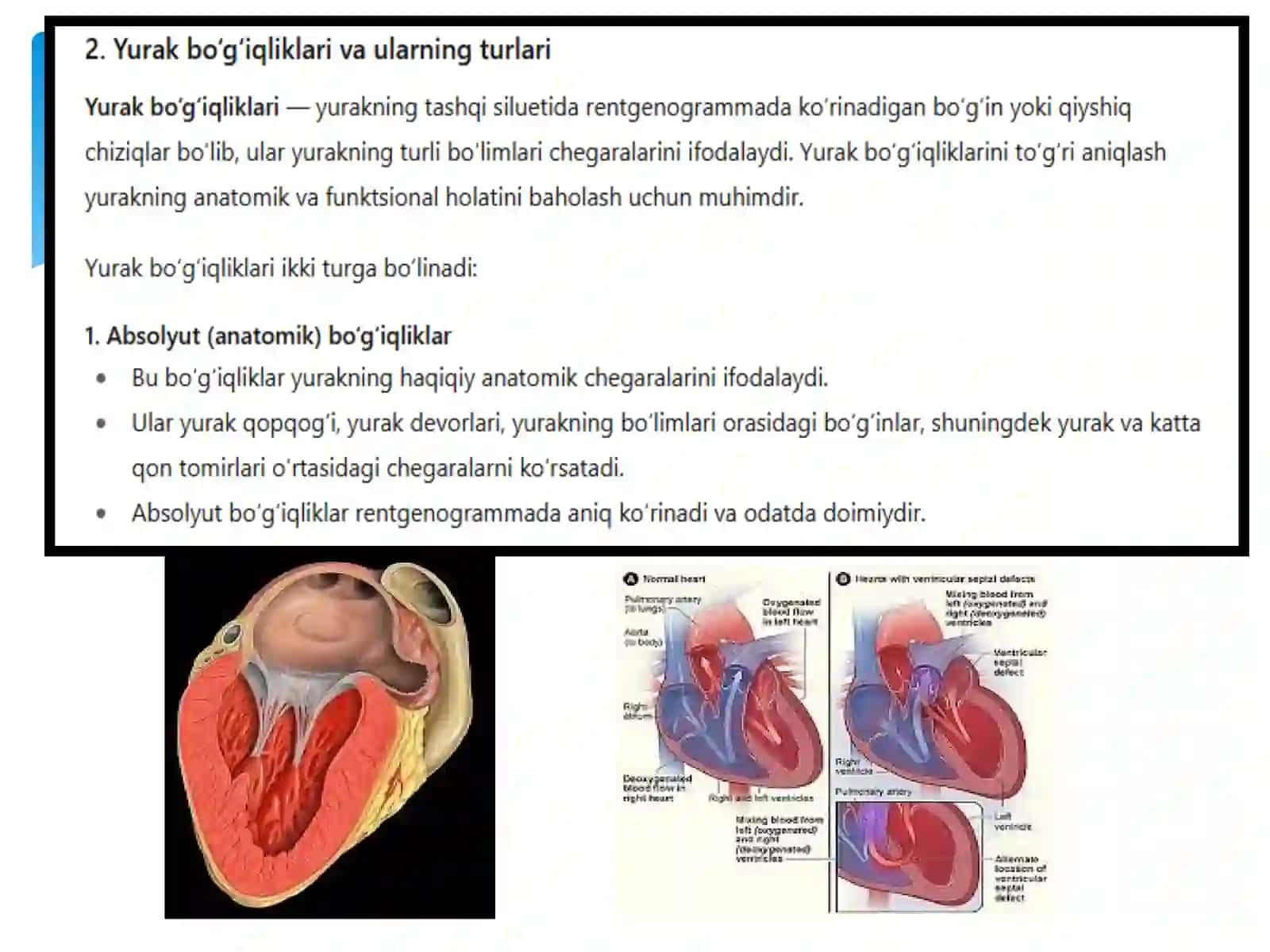 Sog‘lom odamda va yurak qon - tomir kasalligi bilan bemorlarda yurakning nisbiy va absolyut bo‘g‘iqlik chegarasini aniqlash 4