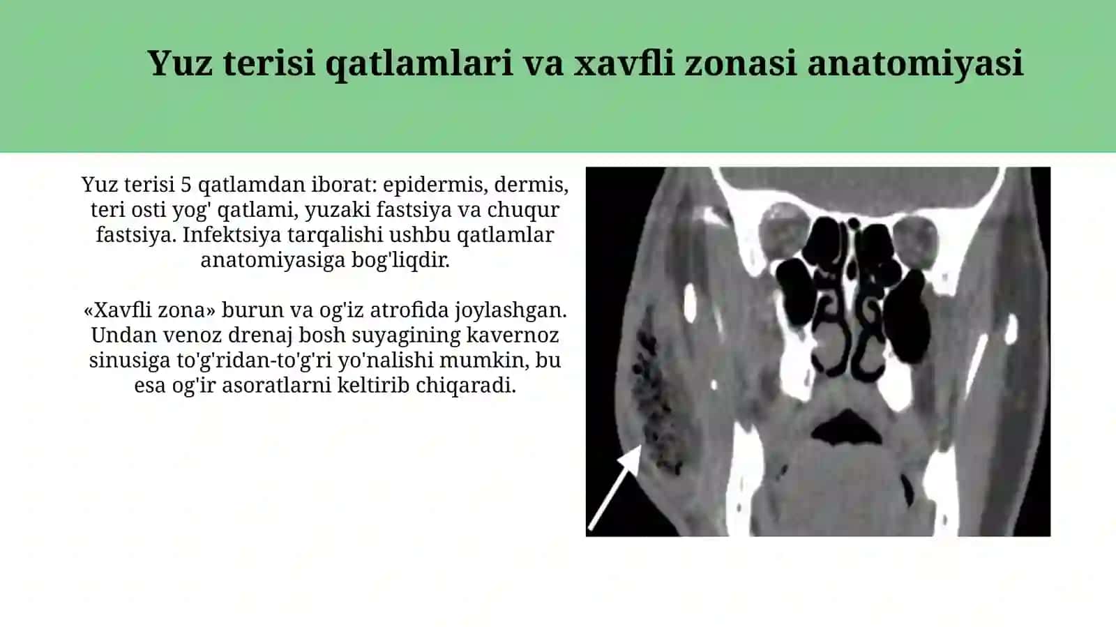 Yuzning yuza flegmonalarining ochish hamda drenejlashning klinikanatomikasoslari 4