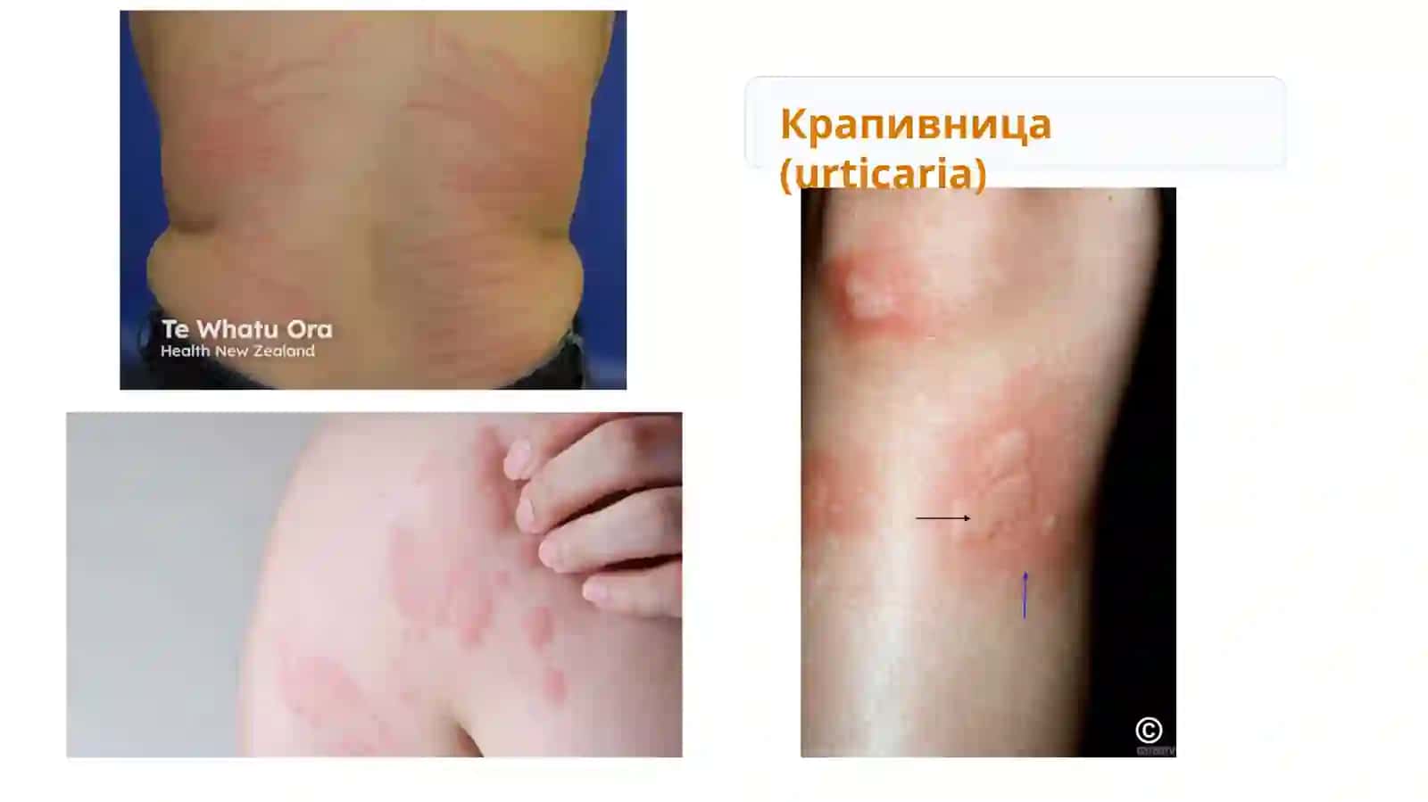 Клинически ориентированная презентация 4