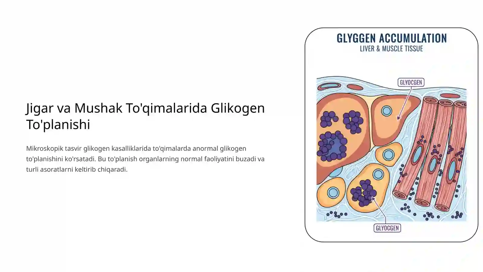 Glikogenkasalliklari 4