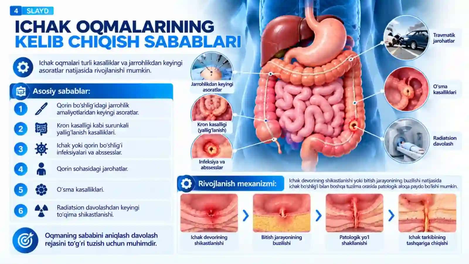 Ichak oqmalarini bartaraf etish usullari.pptx 4