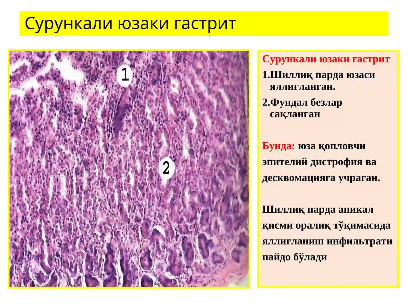 Ошкозон-ичак касалликлари 4