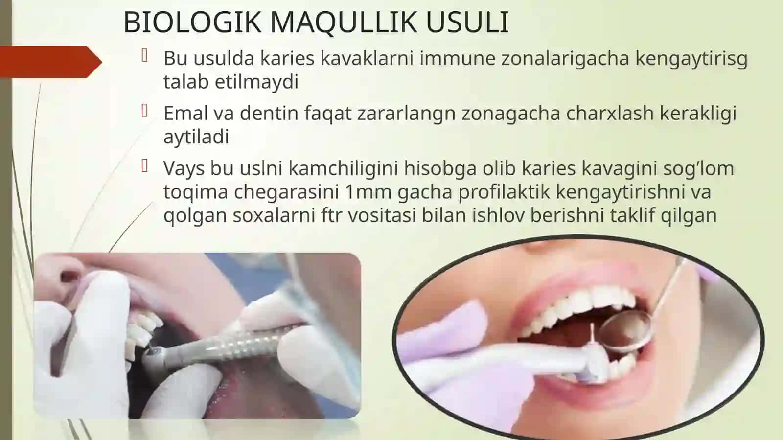 TISH QATTIQ TO‘QIMALARINI CHARXLASH TAMOYILLARI 4