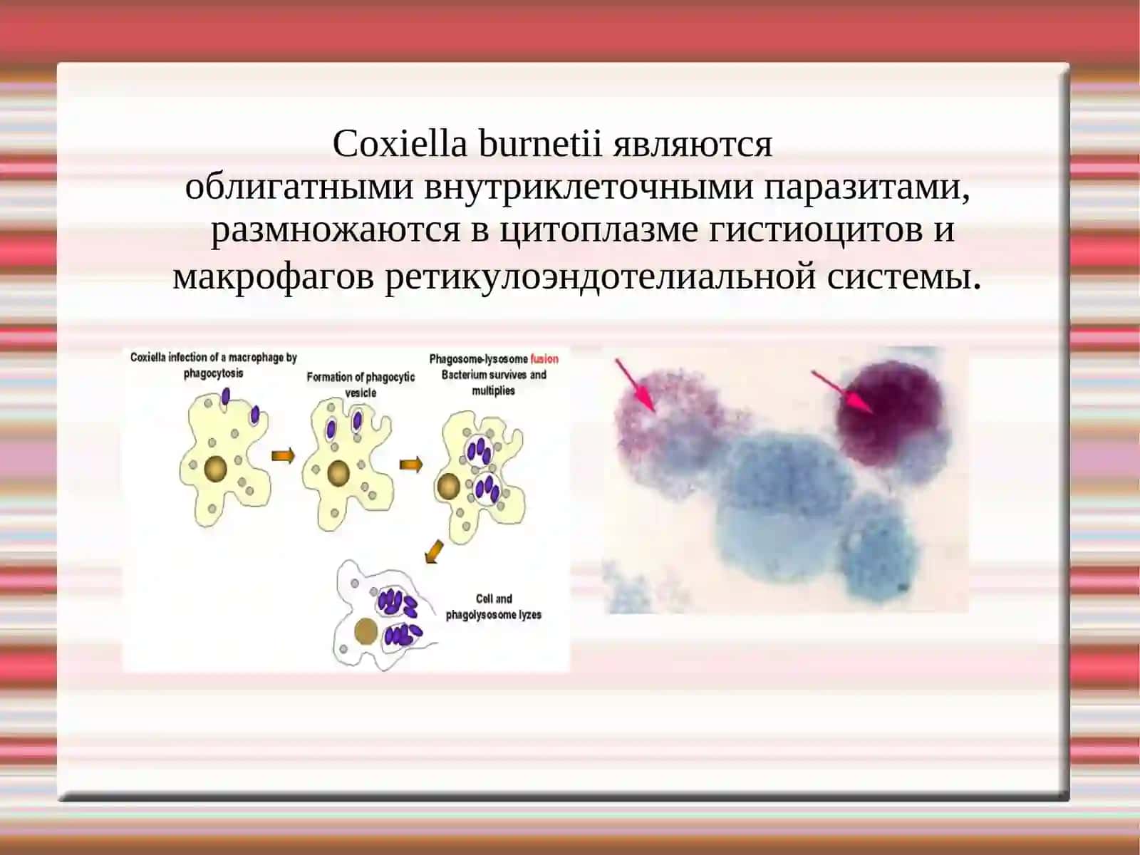 Coxiella burnetii 4