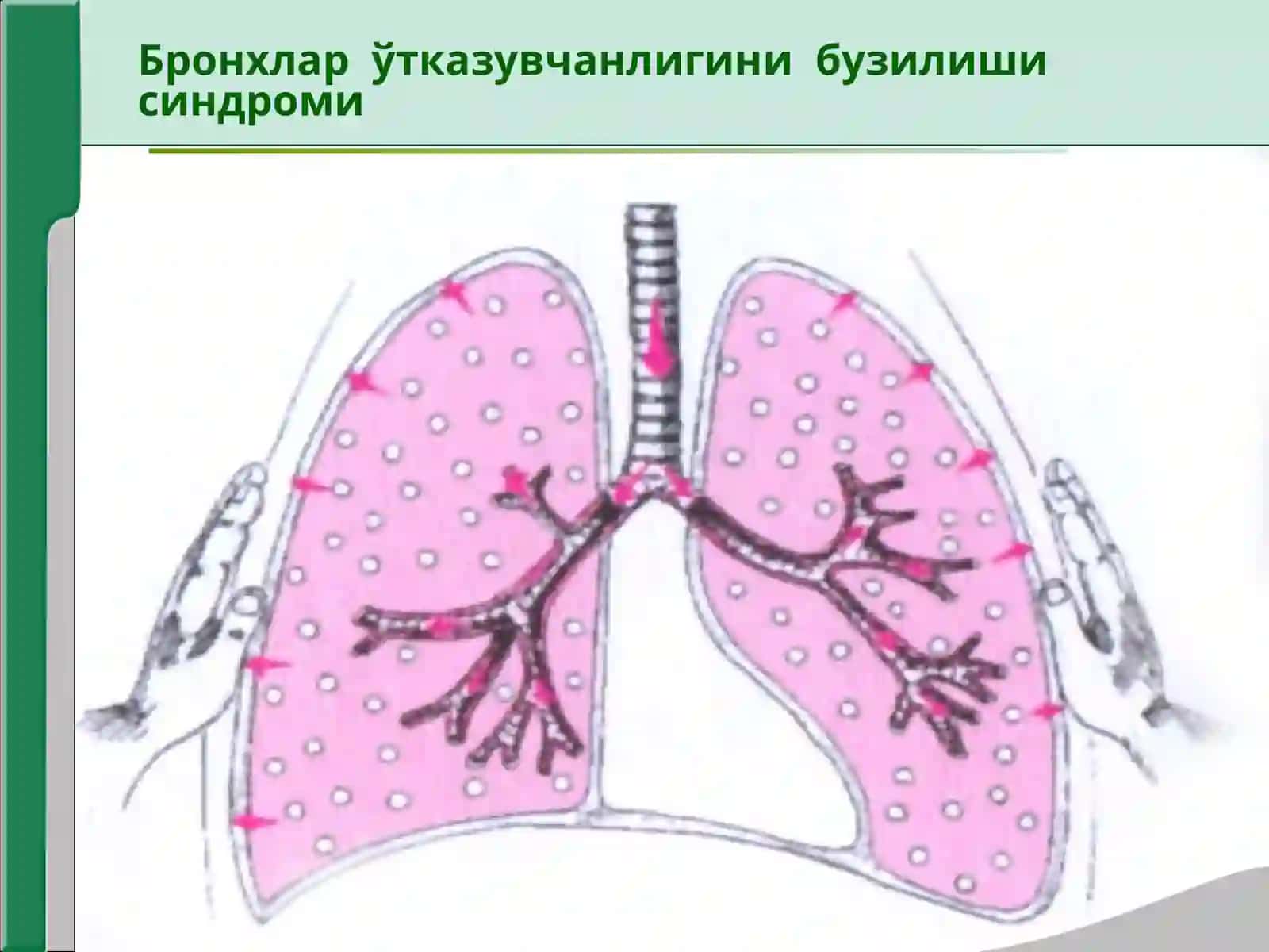 Нафас органлари касалликларида асосийклиник синдромлар 4