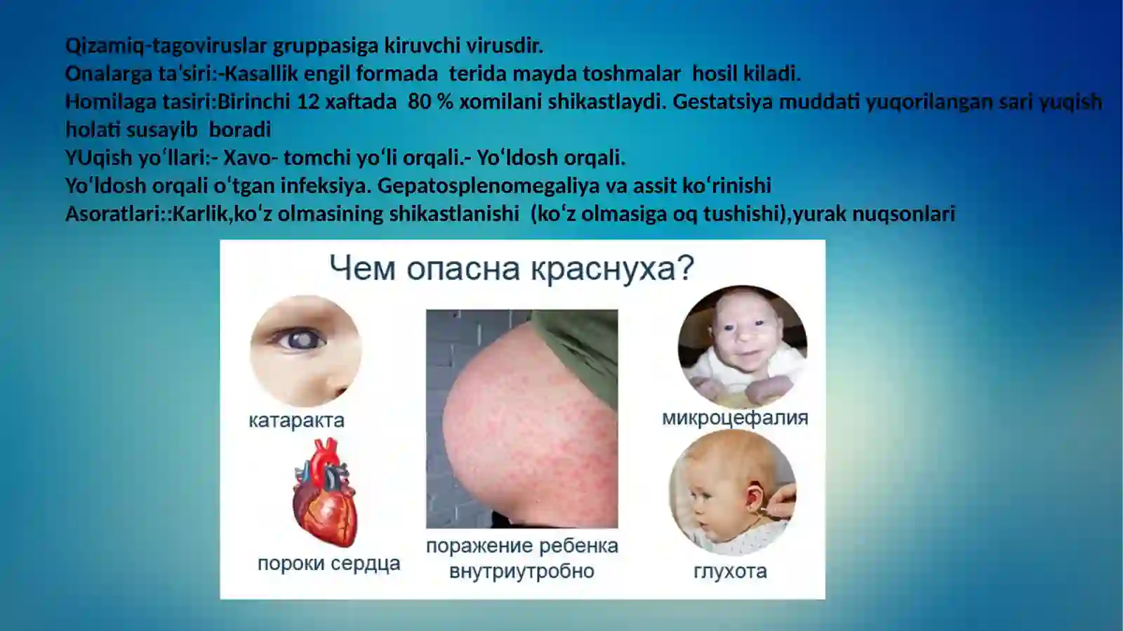 TORCH infeksiya 4