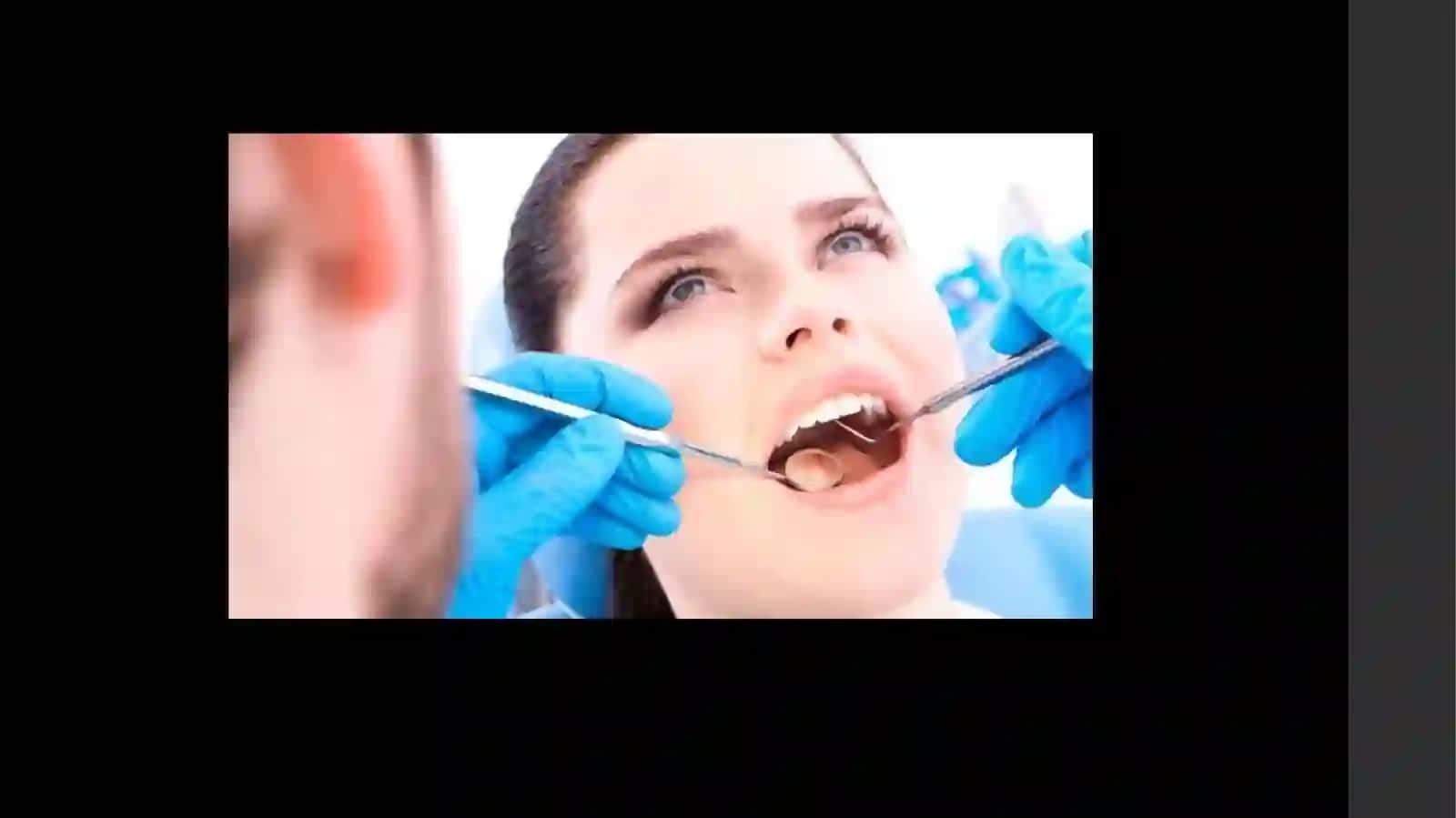 Yuz jag’ sohasini tekshirish asoslari, Stomatologik bemorlarni tekshirish usullari (urib ko’rish, zondlash, paypaslash). Tish kasalliklari: karies, pulpit, periodontit 4