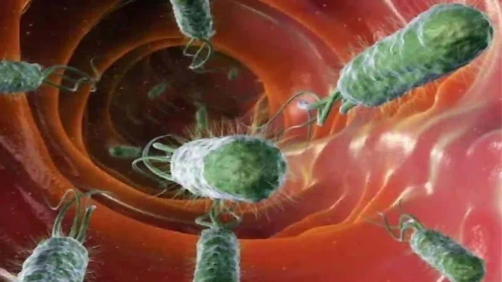O'tkir ichak infeksiyalari epidemiologiyasi va profilaktikasi 4
