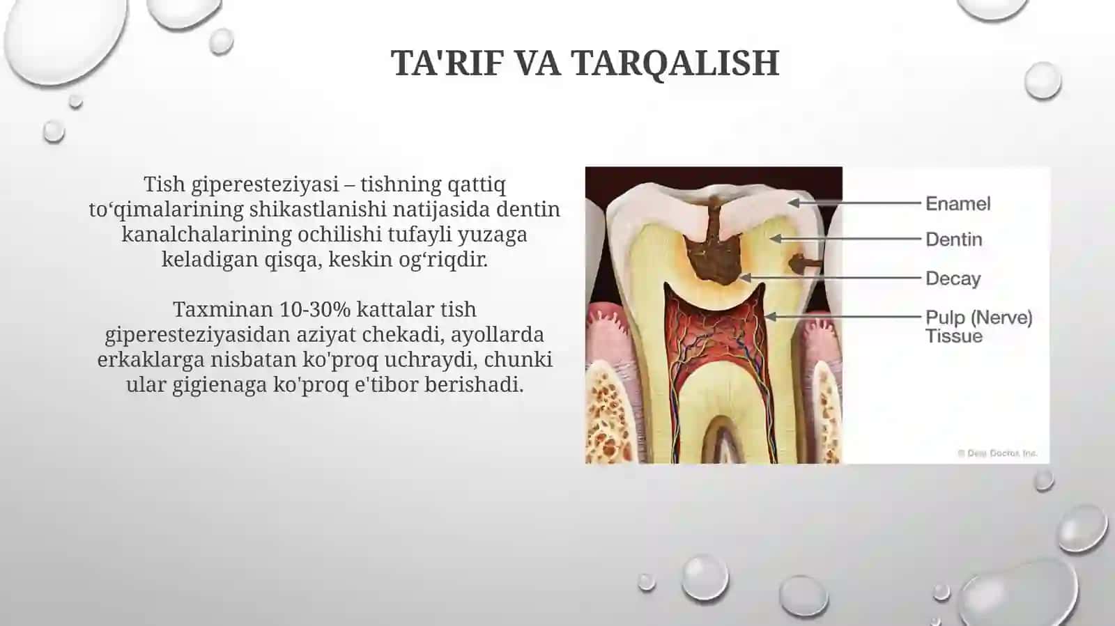 Tishlarning giperesteziyasi 4