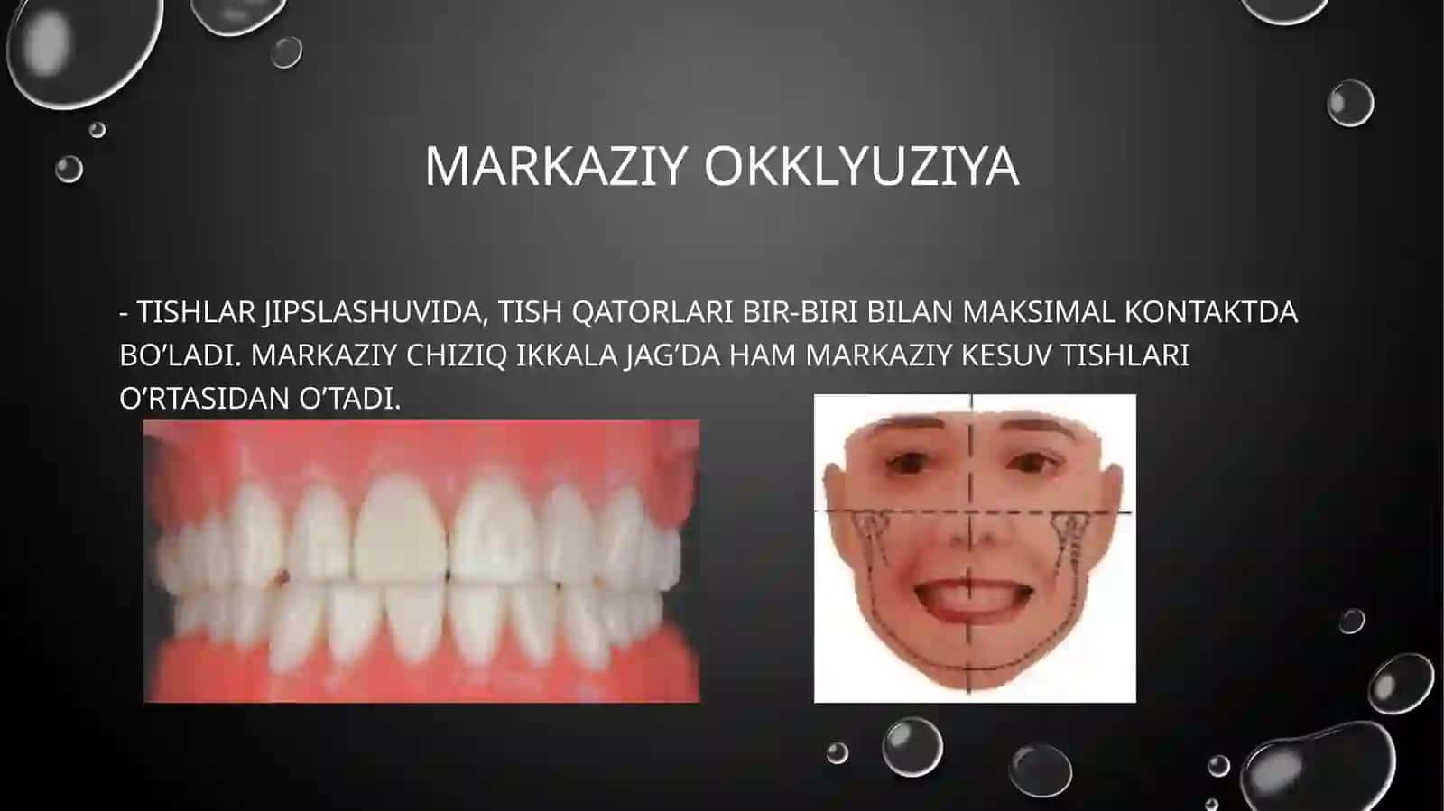 markaziy okklyuziyani aniqlash usullari 4