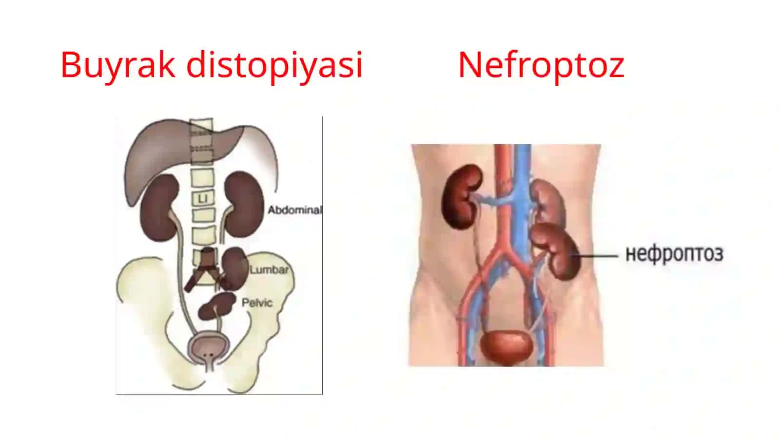Buyrakdistopiyasi 4