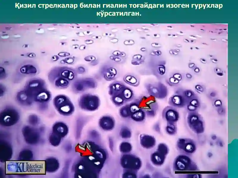 Тогай ва суяк тукималар 4