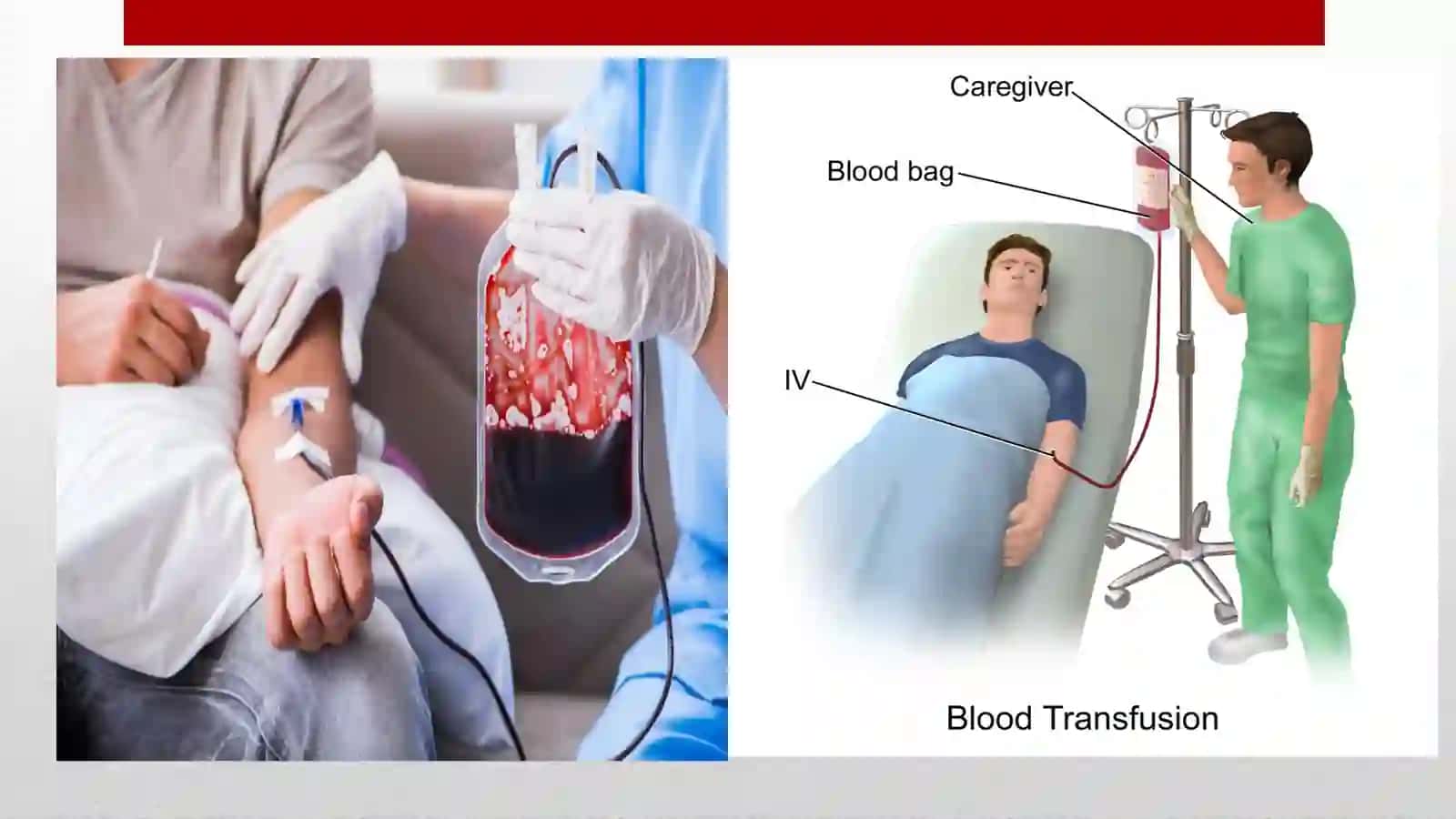 Sitratdan zaharlanish sabablari, klinikasi va klinikasi tashxisi 4
