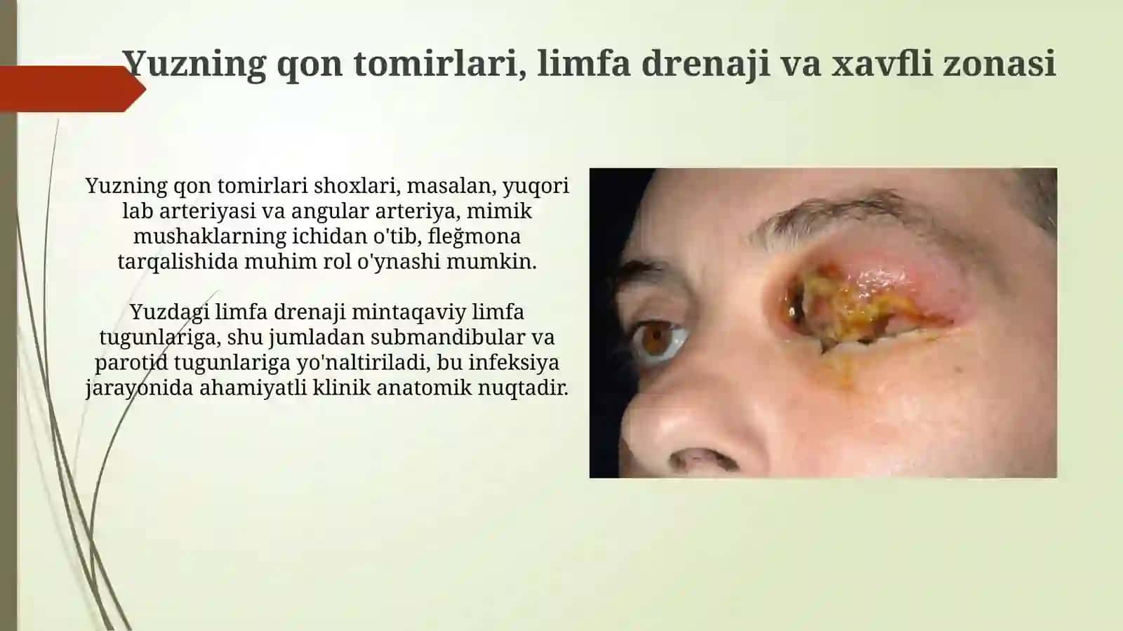 Yuzning yuza flegmonalarining ochish hamda drenejlashning klinikanatomikasoslari 4