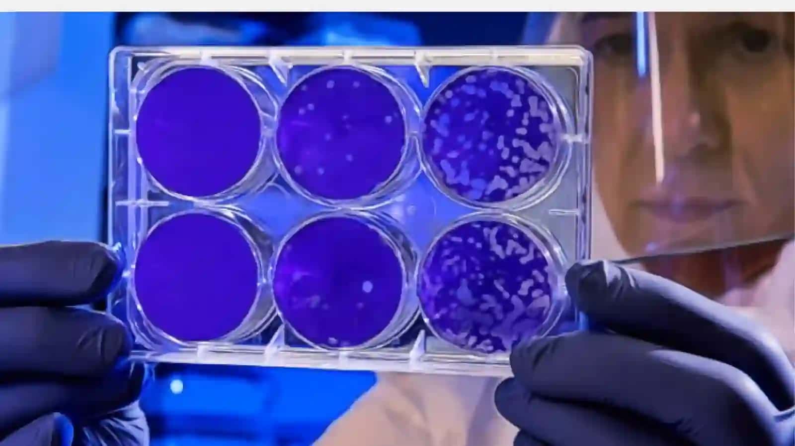 Mavzu: Bakteriyalarning antibiotiklarga chidamli shakllarini paydo bo`lish mexanizmlari haqida to'liq ma'lumot 4