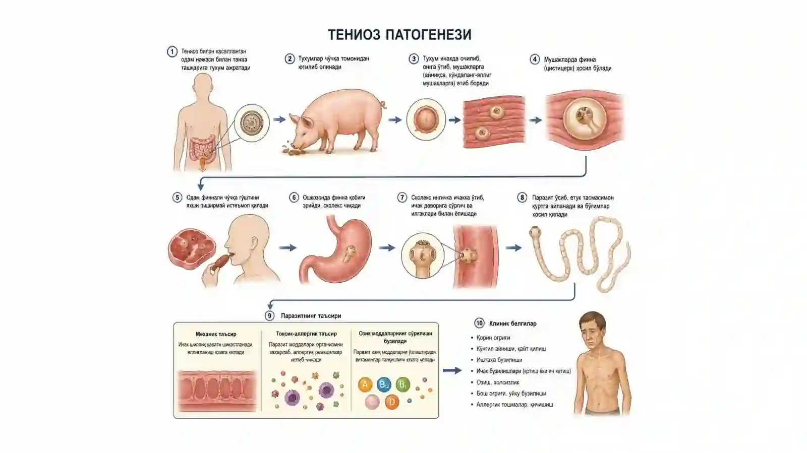 Тениоз 4