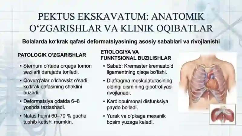 Bolalarda torakotomiya qilish xususiyatlari. Tug'ma va orttirilgan ko'krak qafasi va diafragmani 4